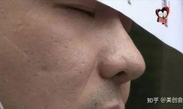 徐州医美媒体爆料案件最新,揭开行业黑幕，患者权益再引关注